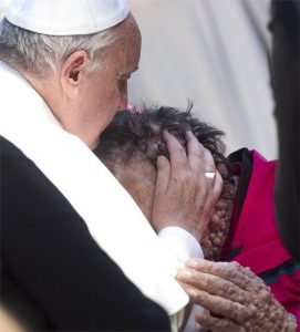 Pope Francis disfigured man 1